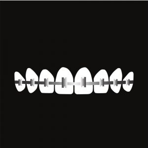 Braces